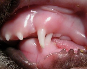 Traumatic Malocclusion with Canine Tooth